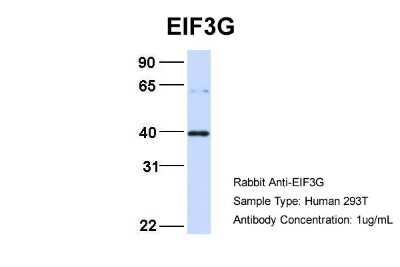 Western Blot: EIF3G Antibody [NBP3-10537]
